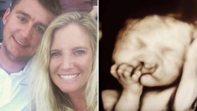 Photo of Parents Refuse To Abort ‘Deformed’ Baby — Look At Him 2 Years Later