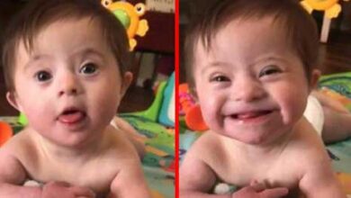 Photo of Adopted baby girl with Down syndrome melts millions of hearts after showing adoptive mom her “new smile”