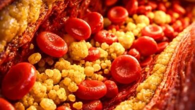 Photo of They’ve Been Lying About Cholesterol for 40 Years – Sardinia Proves It