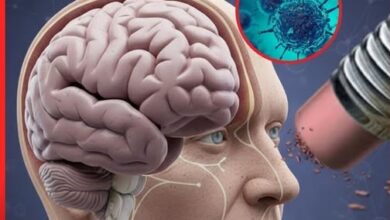 Photo of Everything We Knew About Alzheimer’s Just Got Flipped – It’s Not a Brain Disease After All?