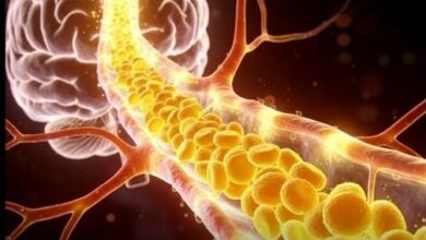 Photo of High Cholesterol in Your 40s Could Be Silently Setting You Up for Dementia – New Warning from Top Experts