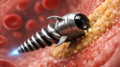 Photo of Tiny Nanobots Are Swimming Through Your Arteries to Blast Away Cholesterol – No Surgery Needed!