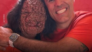 Photo of Born with Tumors Covering Her Body – But This Brazilian Mom of 4 Is a True Warrior Who Refuses to Give Up!