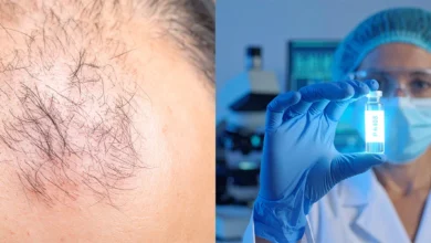 Photo of Baldness Cure Incoming? UCLA’s PP405 Wakes Up Dead Follicles – Hair Grows Back in WEEKS!
