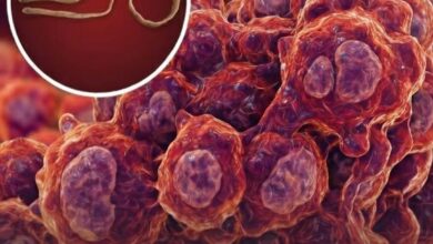 Photo of Until now, cancer has been understood as a disease originating from mutations in a patient’s own DNA. However, this case demonstrates that cells from a parasite can develop cancer and transmit it to a human host.