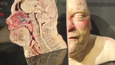 Photo of This Is What a Donated Human Body Looks Like After Science Gets It – Mind-Blowing Slices