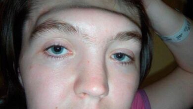 Photo of She Put Her Feet on the Dashboard – The Horrifying Crash That Destroyed Her Face