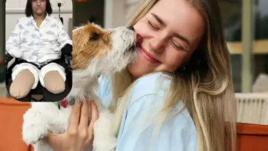 Photo of Her Dog Licked a Tiny Scratch… 24 Hours Later She Lost Both Hands and Legs to Sepsis