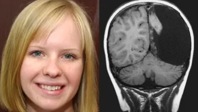 Photo of “150 Seizures a Day: 8-Year-Old Had Half Her Brain Removed – Now She Has a Master’s Degree and a Full Life”