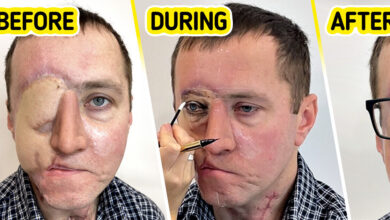 Photo of “Tired of Scalpels and Doctors: How a Medical Tattoo Gave Pavel His Eye Back”
