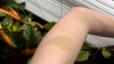 Photo of “She Sent Me This Photo After Her Job Interview – The Red Marks on Her Knees Said Everything”