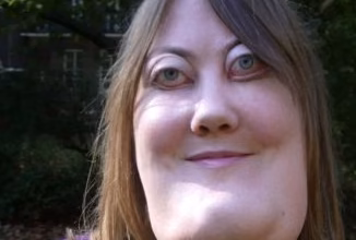 Photo of Born with a Rare Condition That Destroyed Her Face, Victoria Wright Refused to Hide