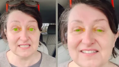 Photo of “Her Eyes Turned Bright Green After a Routine Eye Exam – And It’s Not What You Think”