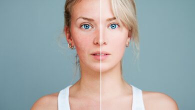 Photo of “Influencers in Norway Face Fines for Posting Edited Images Without Warning Label”