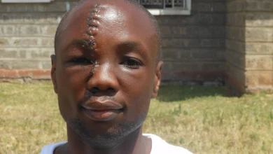 Photo of “Hero Caretaker Fights Off Intruders to Protect Sleeping Children – His Courage Raised $80,000”