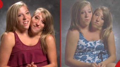 Photo of “Conjoined Twins Abby and Brittany: Two Teaching Degrees, One Paycheck”