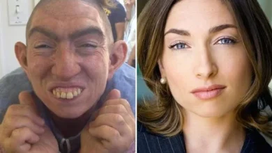 Photo of “The Shocking Transformation Behind Pepper: Naomi Grossman’s Unforgettable Role in American Horror Story”